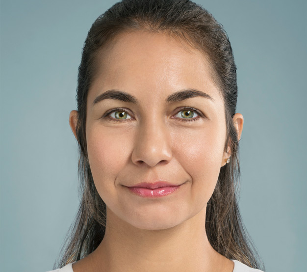 Celine-Front-Facing-After