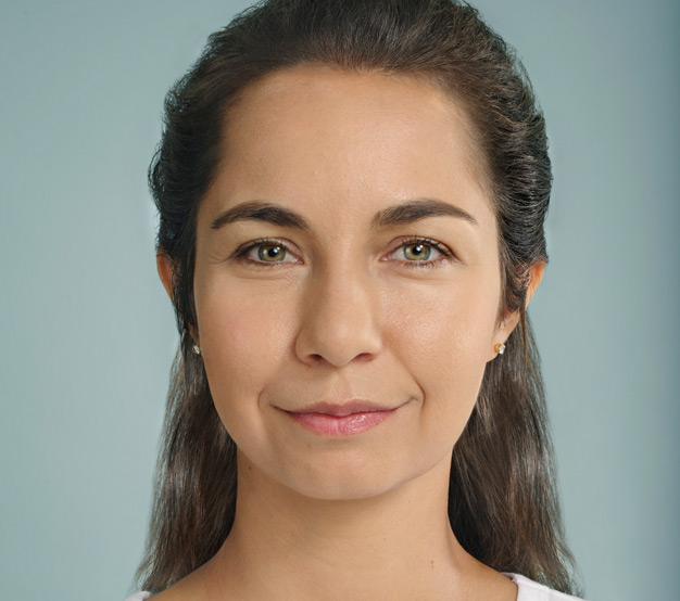 Celine-Front-Facing-Before